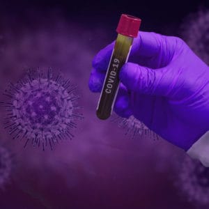 Nuevo caso positivo de coronavirus en Flores